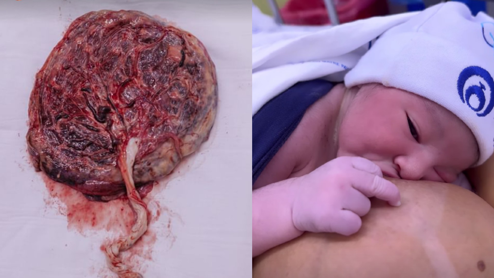 Placenta e bebê de Fernanda Lacerda