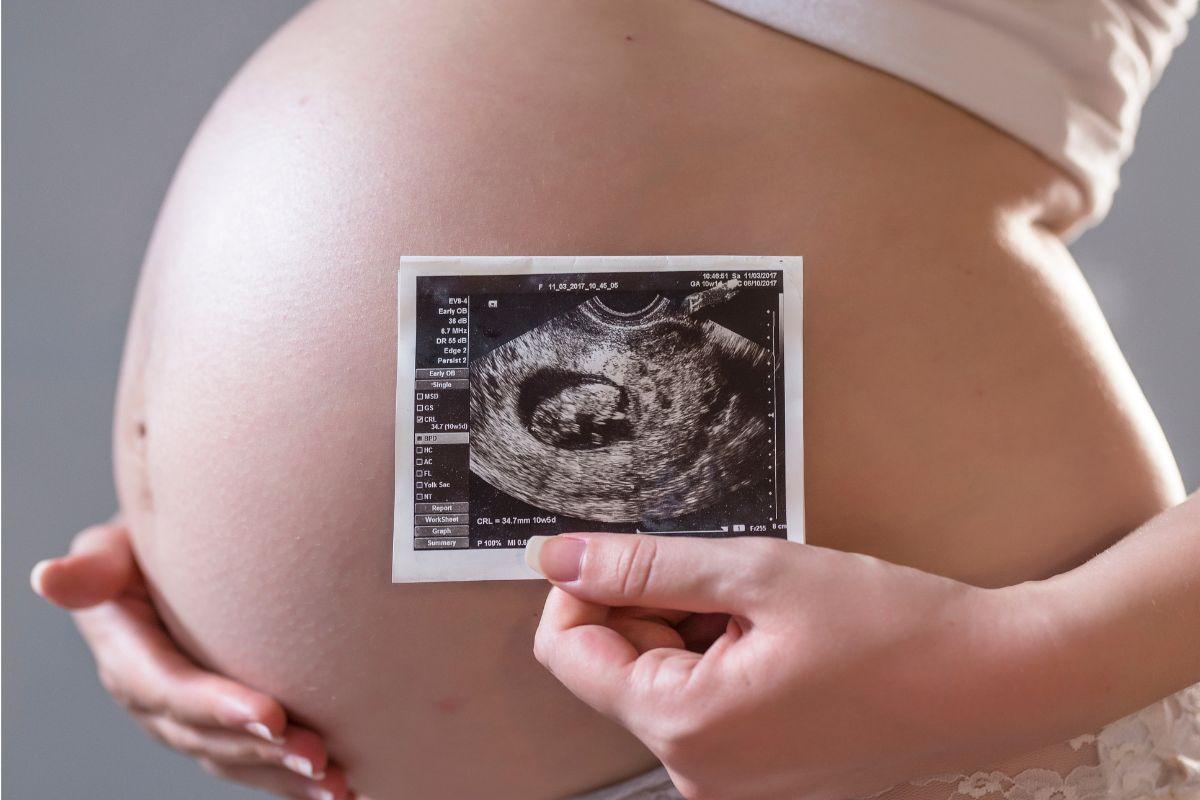 Mulher gravida com ultrassom