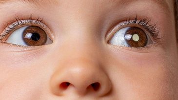 Lesões oculares em crianças - (Foto: Getty Images)