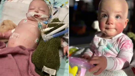 Bebê engole pacote de bolinhas e passa 4 meses no hospital - Arquivo Pessoal Fohlicia Mitchell 