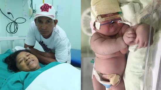 O ‘bebê gigante’ nasceu no Amazonas - Divulgação/Hospital Padre Colombo