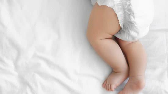 Irritações à pele sensível do bebê podem ser evitadas com cuidados reforçados - Getty Images