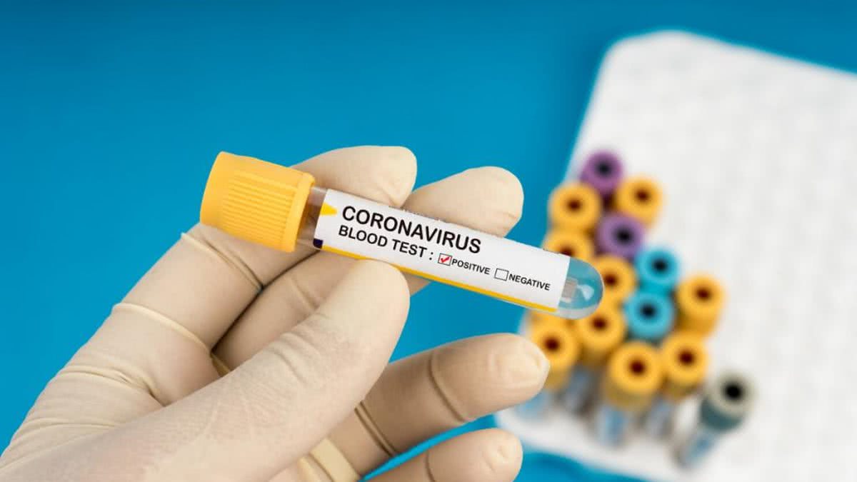 Pessoas tentam se proteger contra o coronavírus - Getty Images