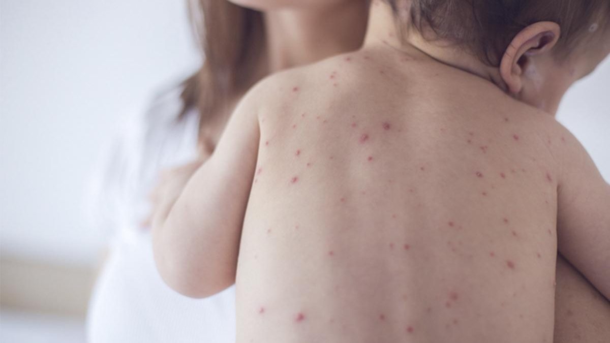A importância com a vacinação só aumenta - Getty Images