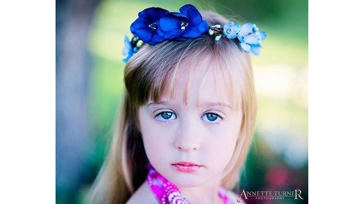 Chrissy Turner 2 - A menina tem apenas 8 anos e enfrenta o câncer como gente grande