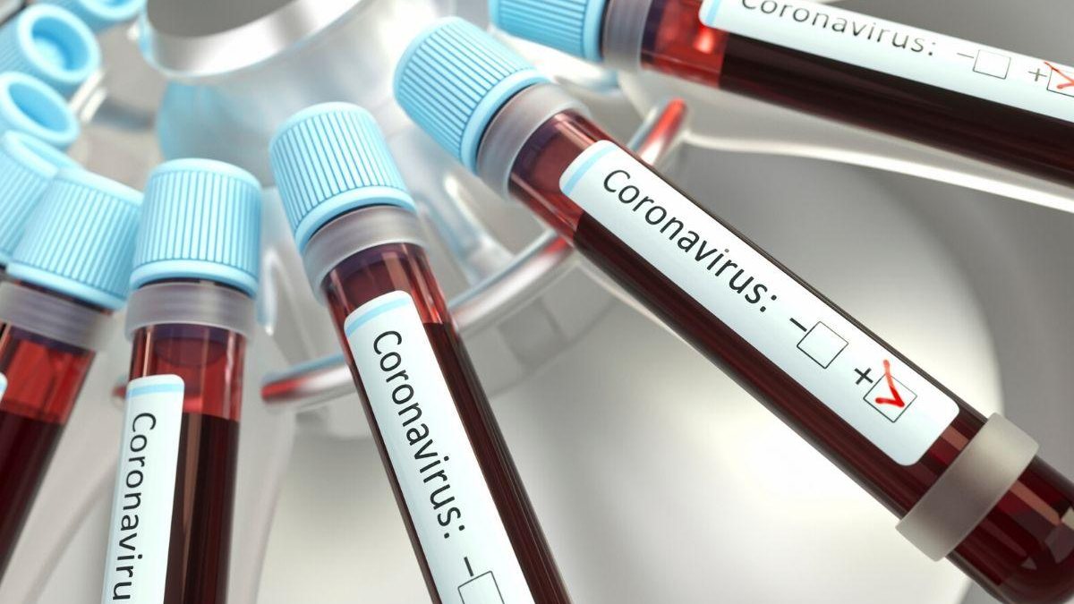 O novo coronavírus tem taxa de fatalidade menor que a da gripe - Reprodução/Getty Images